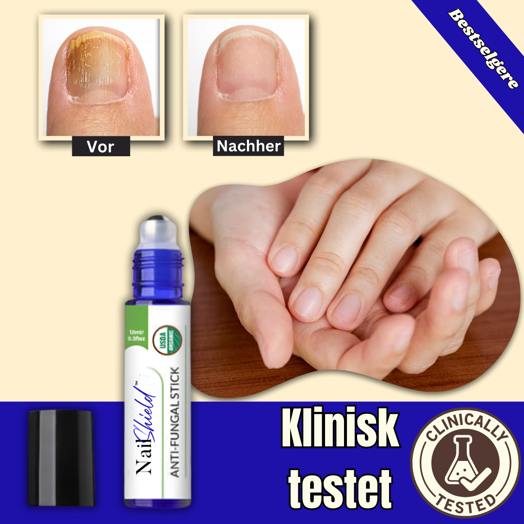 NailShield™ - Anti Fungal Stick | Eliminerer neglesopp på 6 dager