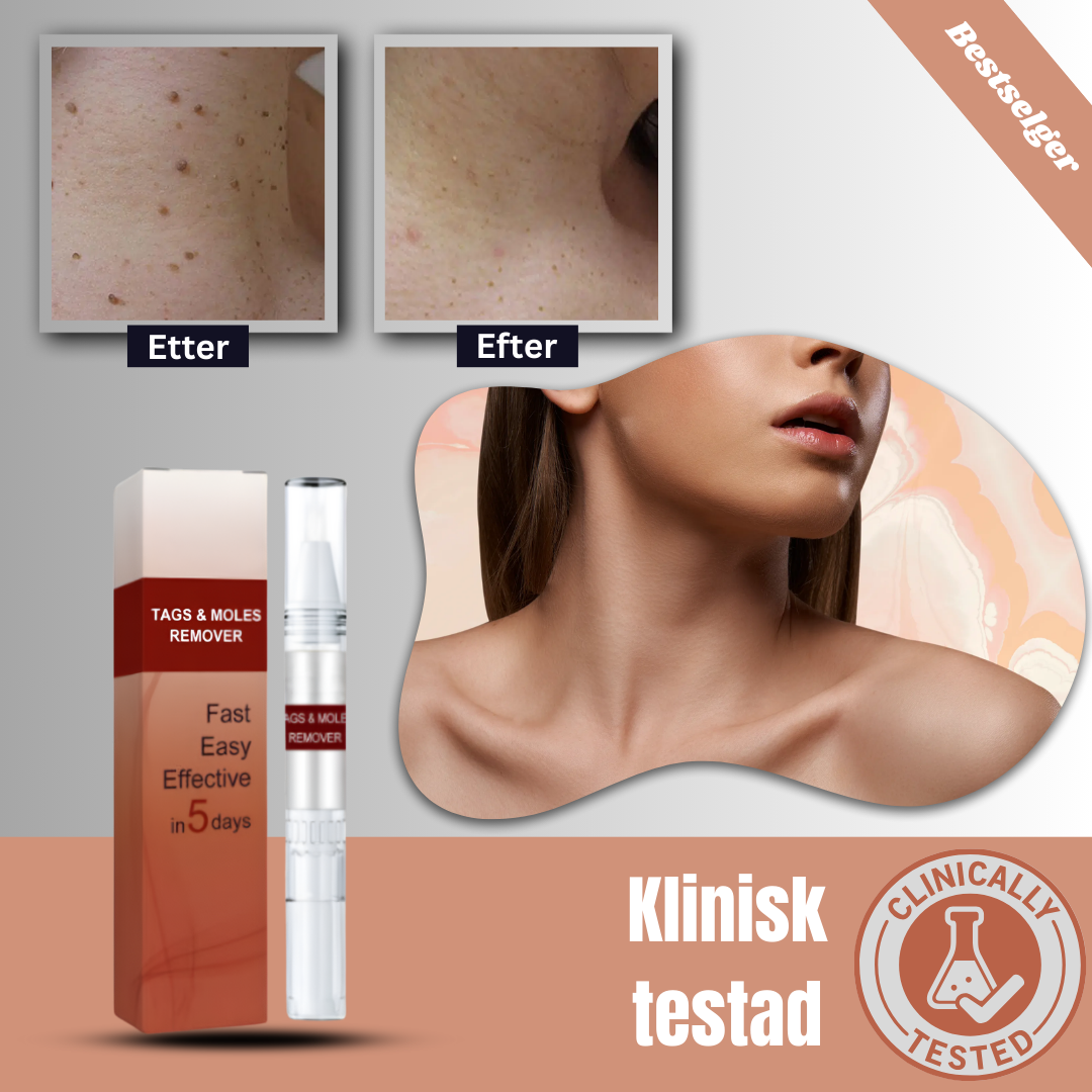 SkinSmooth™ - Krem | Eliminerer hudflaker på 6 dager, uten problemer